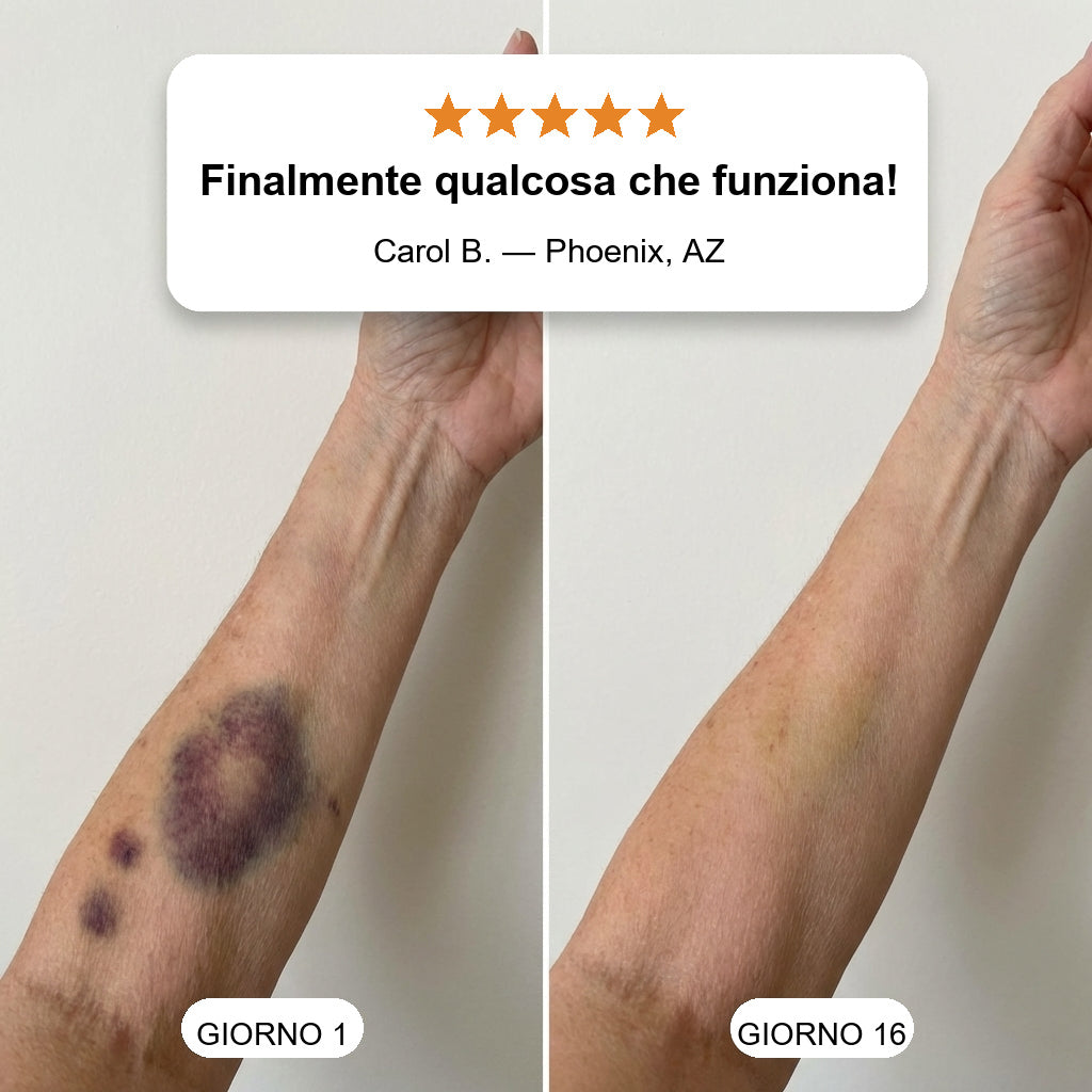 👨‍🔬💥 OLTRE 100MILA PEZZI VENDUTI💕 - Crema Riparativa Contro Lividi e Tonificante Per la Pelle CureVivo®-cod802