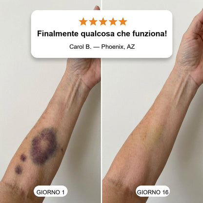 👨‍🔬💥 OLTRE 100MILA PEZZI VENDUTI💕 - Crema Riparativa Contro Lividi e Tonificante Per la Pelle CureVivo®-cod802