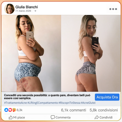 🇮🇹 𝐍𝐞𝐠𝐨𝐳𝐢𝐨 𝐔𝐟𝐟𝐢𝐜𝐢𝐚𝐥𝐞 𝐝𝐞𝐥 𝐁𝐫𝐚𝐧𝐝 | 🍒 LUCKYSONG® 2026 Pantaloni Yoga Snellenti 8-in-1 Termici Brucia Grassi e Push-Up Glutei